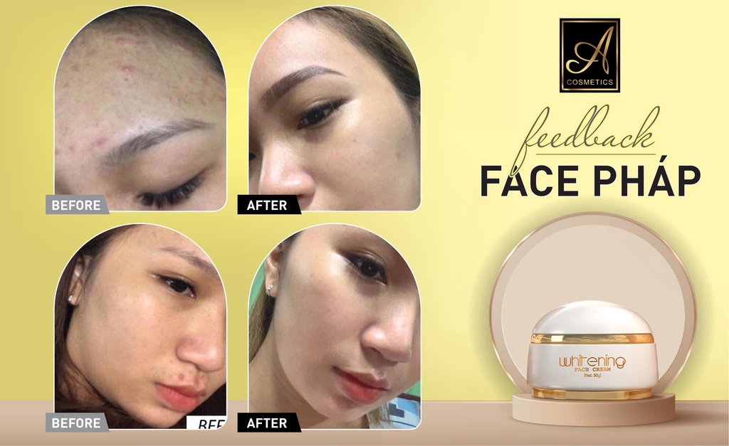  trước và sau khi sử dụng kem face pháp