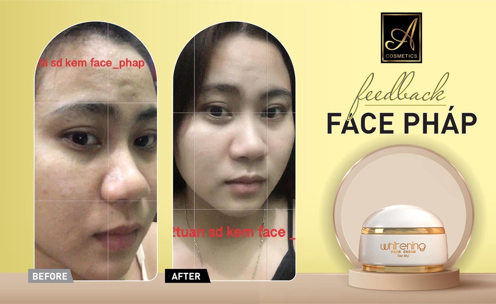 before after kem face pháp